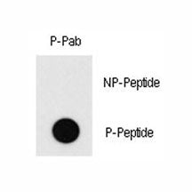 Phospho-MEF2C Antibody (pT20)