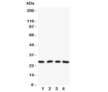 Western blot testing of NPM2 antibody on Lane 1: HeLa; 2: U87; 3: A549; 4: SMMC-7721 cell lysate. Pr
