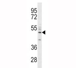 CD14 Antibody