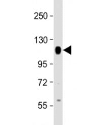 PTPN12 Antibody
