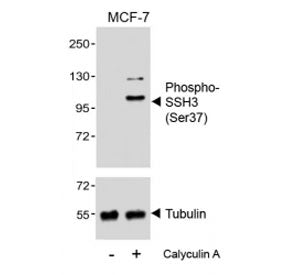 Phospho-SSH3 Antibody (Ser37)