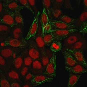 KRT7 Antibody / Cytokeratin 7