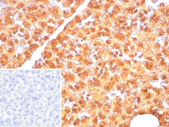 IHC staining of FFPE human pancreas tissue with Pancreatic lipase antibody (clone PNLIP/8916). Inset