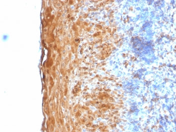 Involucrin Antibody