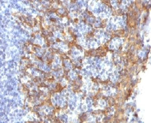 Cytokeratin 14 Antibody / CK14 / KRT14