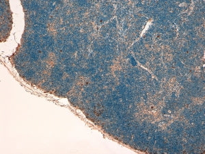 STAT3 Antibody
