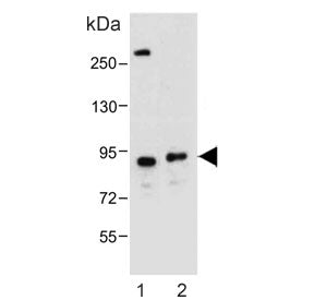 Dystrobrevin alpha Antibody / DTNA
