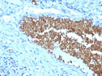 SPTA1 Antibody / Spectrin alpha 1