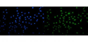 U2AF65 Antibody / U2AF2