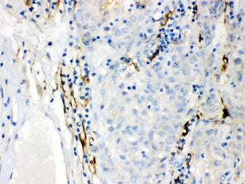 CYP1B1 Antibody