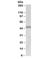 CHIT1 Antibody