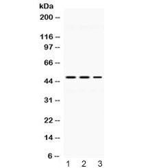 TIP47 Antibody / Perilipin 3 / M6PRBP1