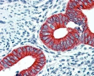 EPB41L2 Antibody