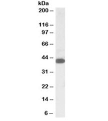 Western blot testing of K562 lysate with A4GNT antibody at 1ug/ml. Predicted molecular weight: ~40kD