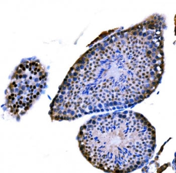 IHC staining of FFPE mouse testis tissue with DMC1 antibody. HIER: boil tissue sections in pH8 EDTA