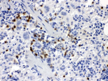 Macrophage Colony stimulating factor 1 Antibody / Csf1
