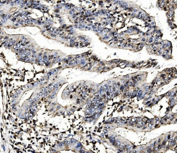 MORC3 Antibody