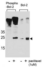 Bcl-2 Antibody (phospho-S70)