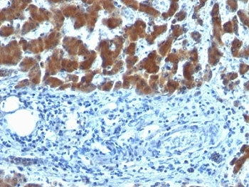 RBP Antibody / Retinol Binding Protein 1