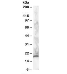 CABP1 Antibody