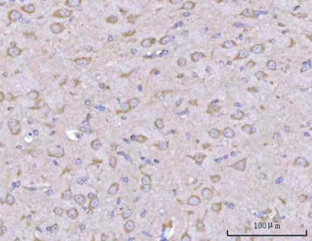 PPFIA2 Antibody / Liprin-alpha-2
