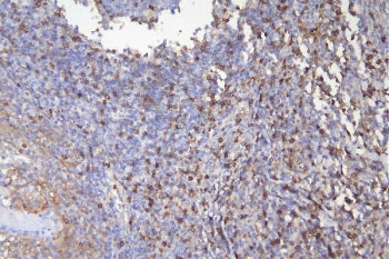CD5 Antibody
