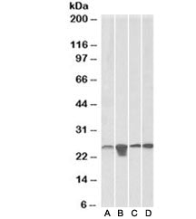 SOD2 Antibody