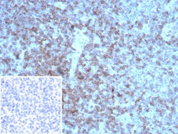 IHC staining of FFPE human tonsil tissue with recombinant LFA-2 antibody (clone rLFA2/8516) Inset: P