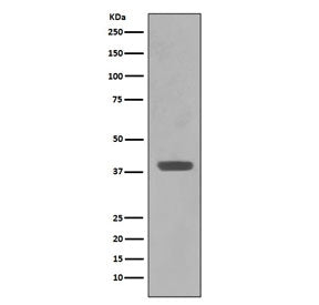 Western blot testing of E. coli lysate with Maltose Binding Protein antibody. Predicted molecular we