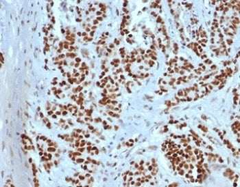 IHC staining of FFPE human colon tissue with recombinant MSH2 antibody (clone rMSH2/6548). HIER: boi