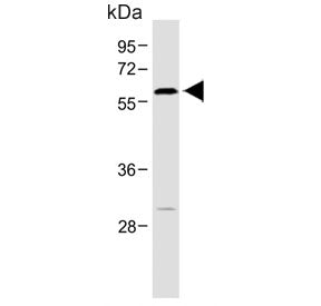 ROR alpha Antibody / RORA