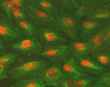 ALKBH5 Antibody