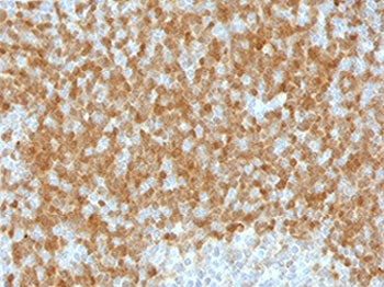 IHC testing of FFPE human lymph node with TCL1 antibody (clone TLLP1-1). HIER: boil tissue sections