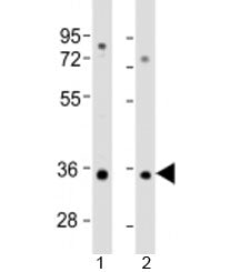 RSPO3 Antibody / R-spondin 3