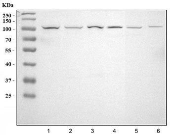 Western blot testing of 1) human HeLa, 2) human MCF7, 3) human MDA-MB-453, 4) rat brain, 5) mouse br