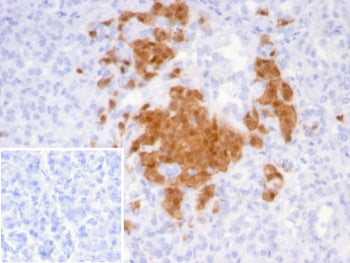 SCGN Antibody / Secretagogin