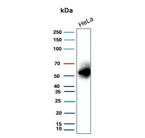 Western blot testing of human HeLa cell lysate with recombinant Carbonic Anhydrase IX antibody. Pred
