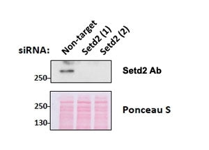 Western blot testing of mouse fibroblast lysates transiently expressing unrelated and two different