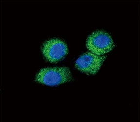 CCL2 Antibody