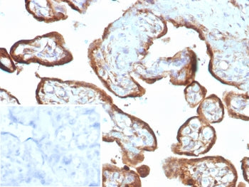 IHC staining of FFPE human placental tissue with recombinant IMP3 antibody (clone IMP3/8985R) Inset: