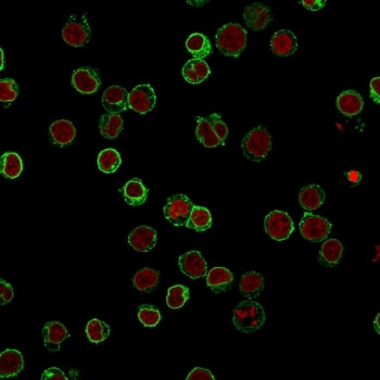 Immunofluorescent staining of FFPE human Jurkat cells with CD3 antibody (green, clone B-B12) and Red