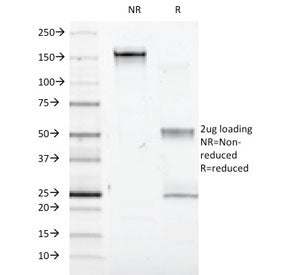 Interferon alpha 1 Antibody / IFNA1