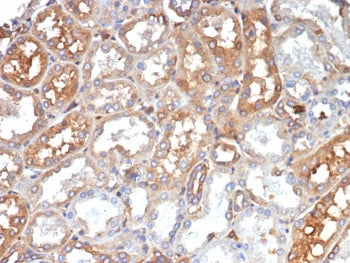Transferrin Antibody