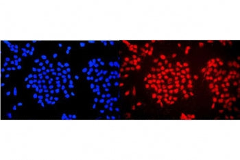 WAC Antibody