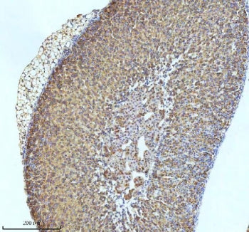 GCLM Antibody / Glutamate-Cysteine Ligase Regulatory Subunit