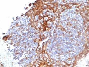 IHC staining of FFPE human tonsil tissue with STING antibody (clone STING1/7436). HIER: boil tissue