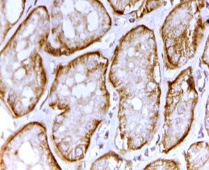 SAT1 Antibody