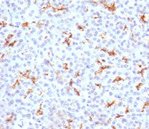 CFTR Antibody / Cystic Fibrosis Transmembrane Regulator