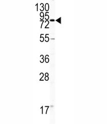 CD31 Antibody