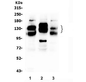 NCAM / CD56 Antibody